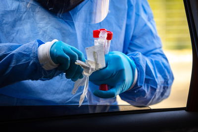 בדיקות קורונה