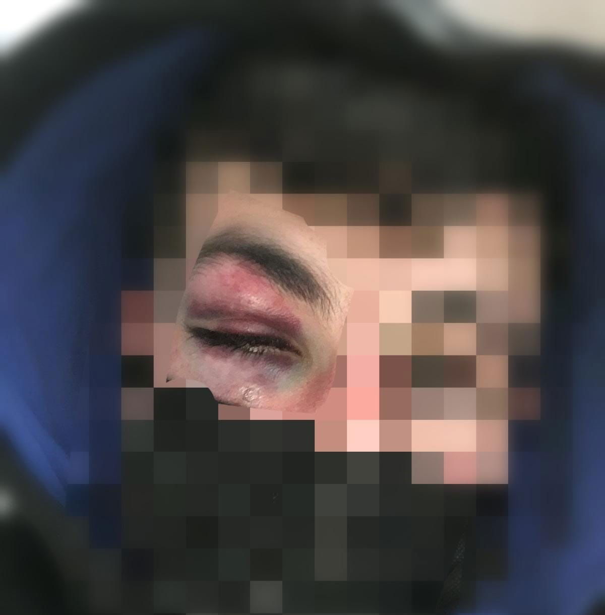 תלמיד הישיבה שהותקף