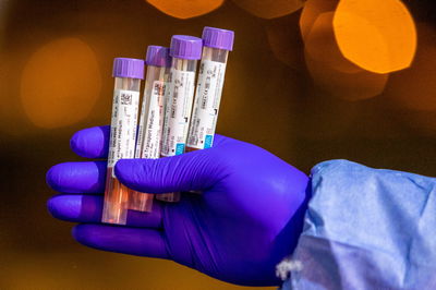 בדיקות קורונה