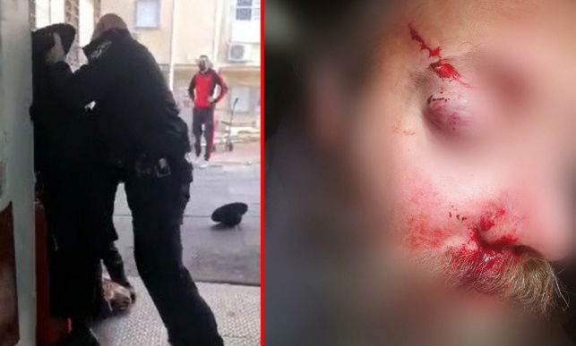 המעצר האלים בבני ברק, שבוע שעבר