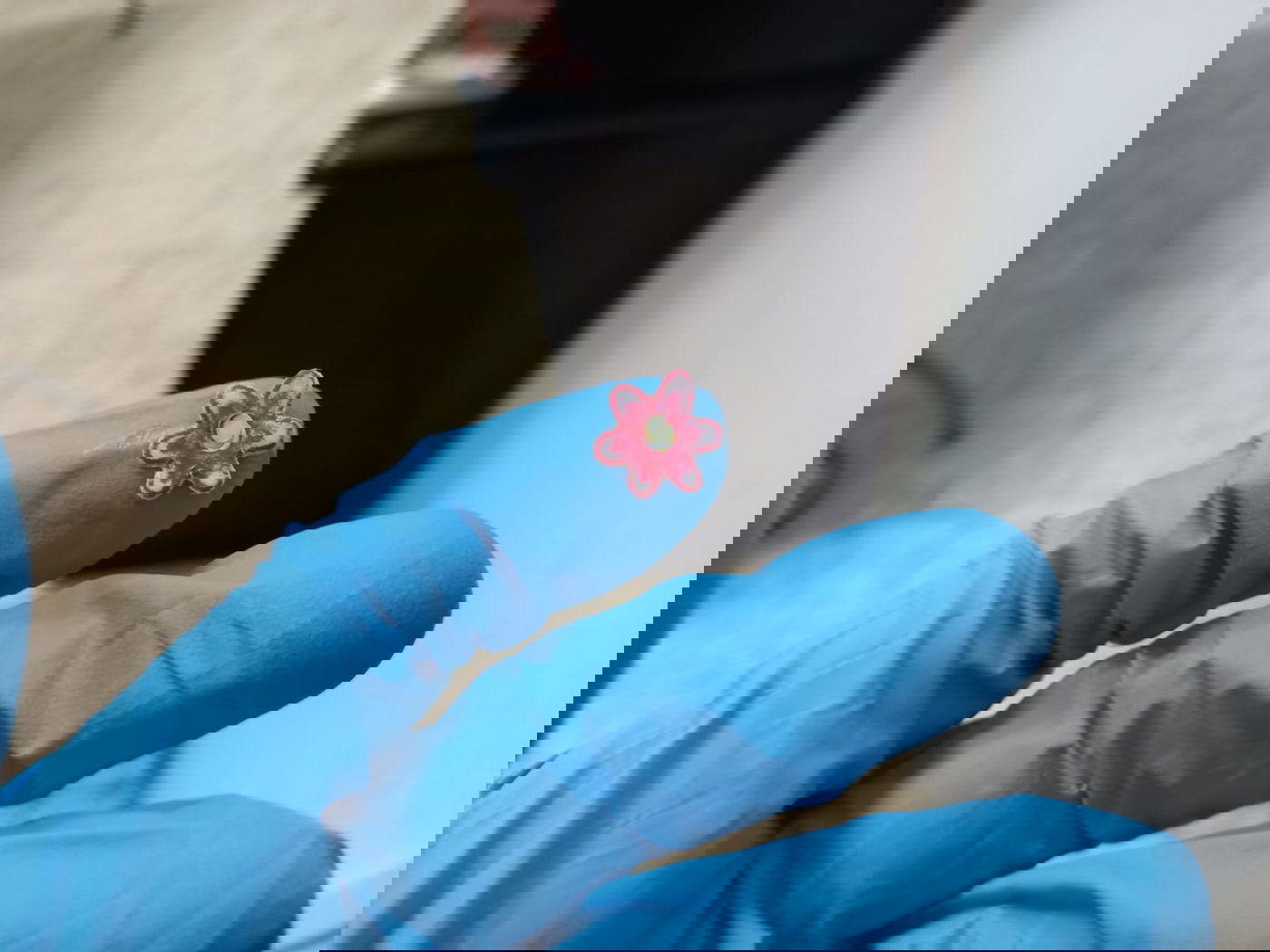 המדבקות שחולצו מקנה הנשימה