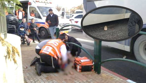 הטיפול בילדה - בעיגול: הנעל של הילדה מתחת לאוטובוס