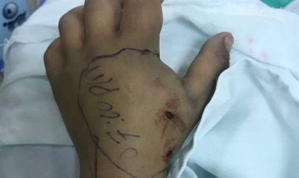 הכשת נחש. אילוסטרציה