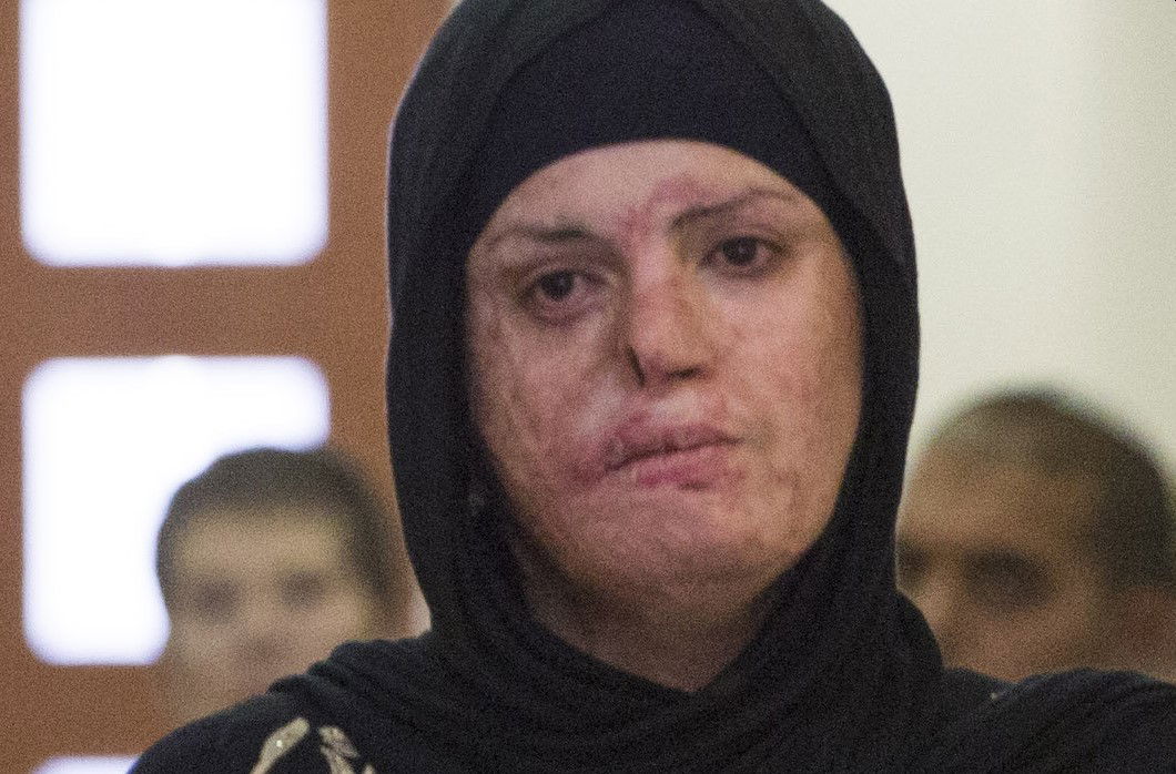 מחבלת בלוני הגז