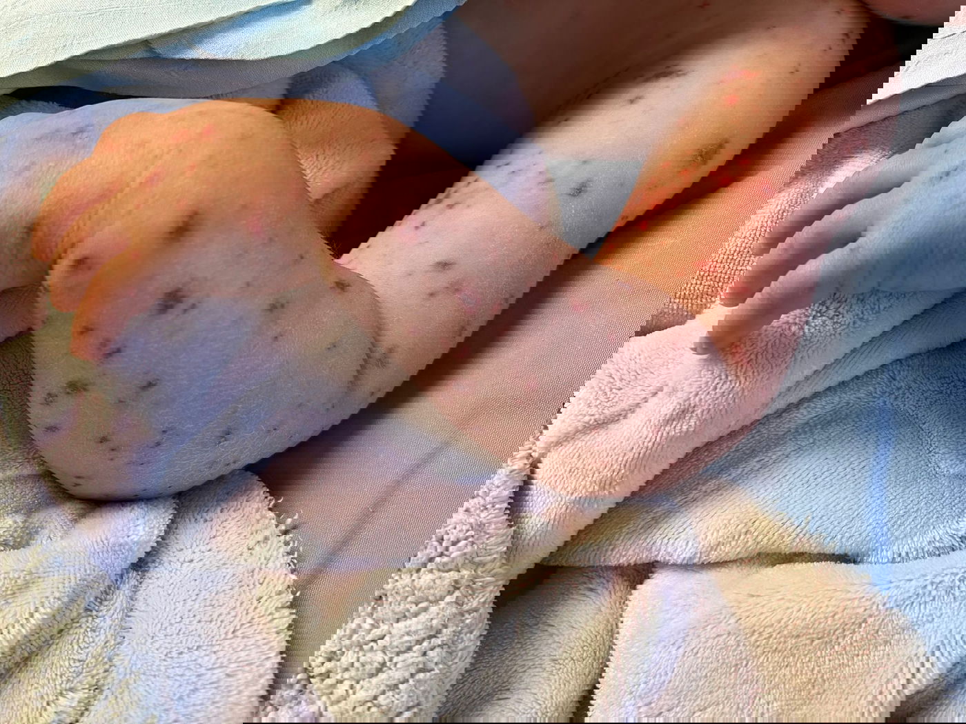 המייל של האימא לרופא - הציל את חיי הפעוטה