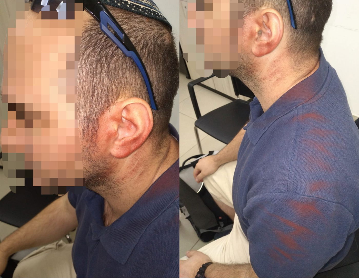 היהודי שהותקף