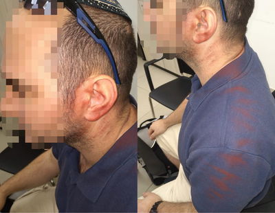 היהודי שהותקף