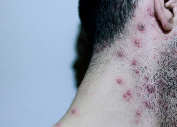 אילוסטרציה