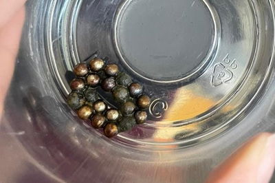 בלע 20 מגנטים אצל חבר