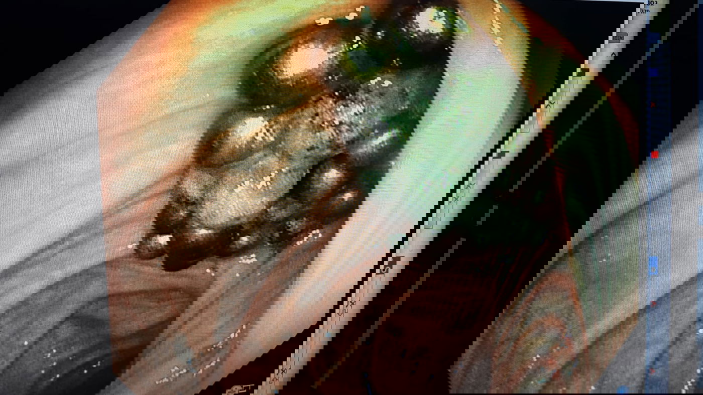 הילד התקשר לאימא שלו: "בלעתי יותר מ-20 מגנטים"