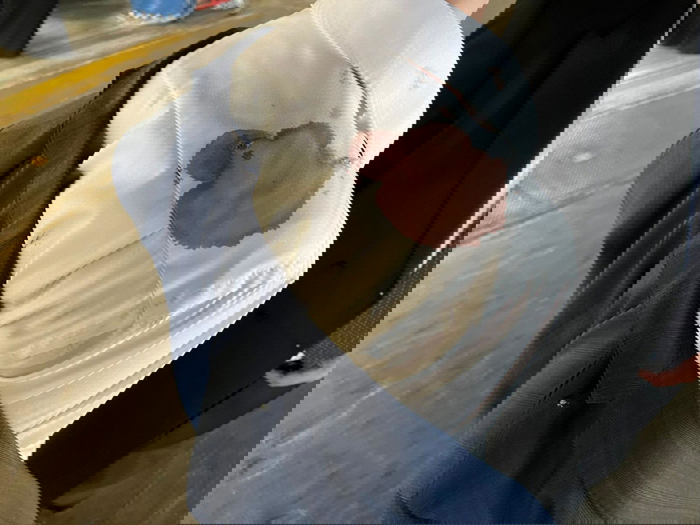 הפגיעה בכתף