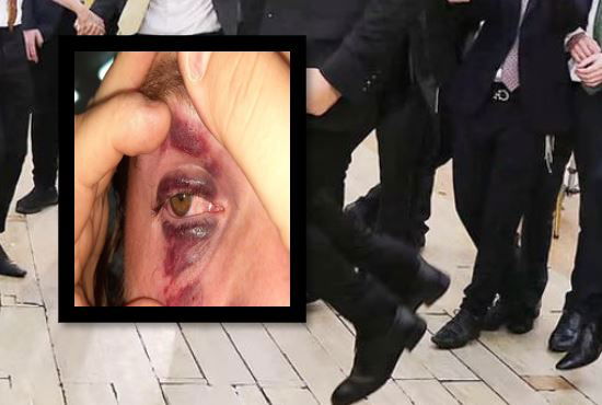 חתונה והעין של החתן, בחתונה אמש