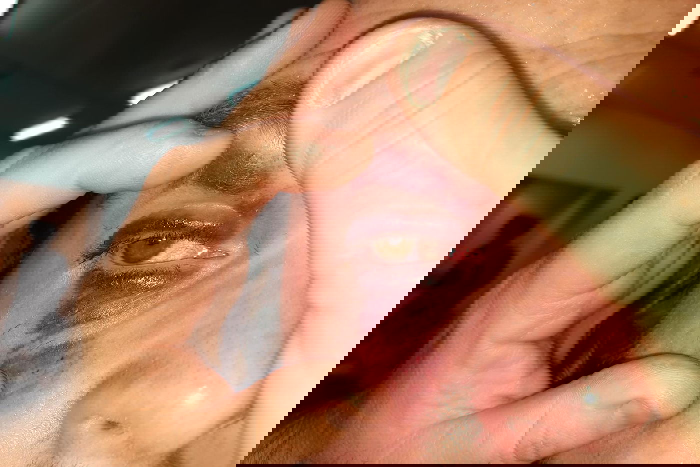 העין של החתן, אמש