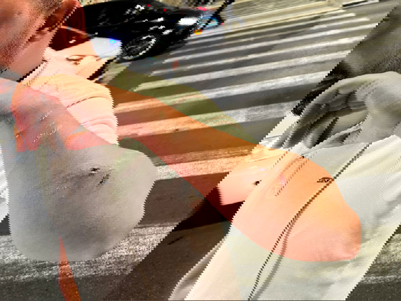 ידו הפצועה של הנער היהודי