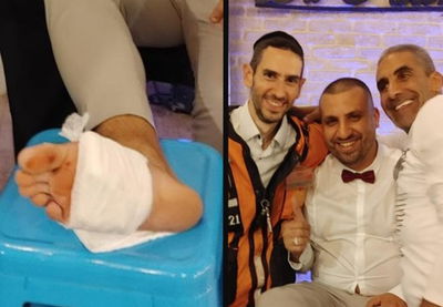 מבוכה מתחת לחופה: החתן שבר את הכוס - ונחתך ברגל