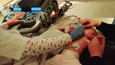 נולדה עם 2 מומים בלב