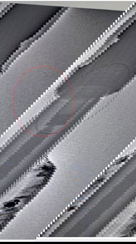 צילום רנטגן בו ניתן לראות כדור האקדח בקנה