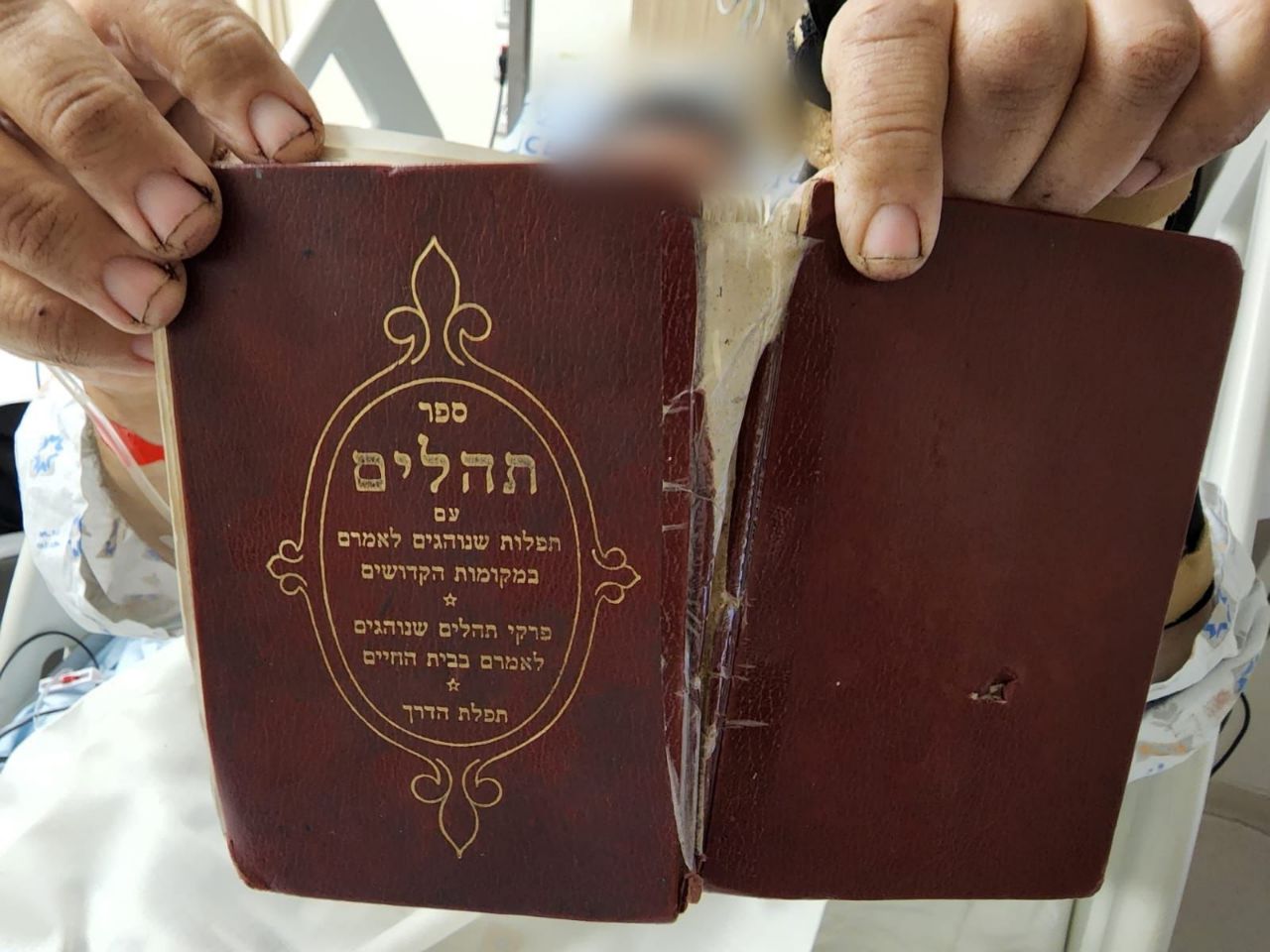 הפצוע ששוחרר עם התהילים