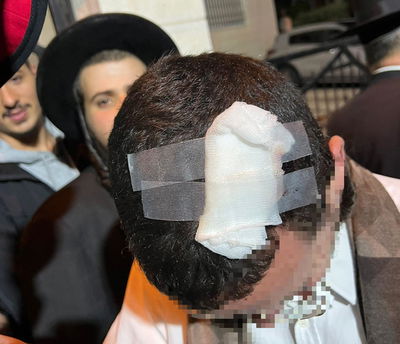 מח"ש תקבל החלטה: מה דין השוטר שתקף חרדי באלה?