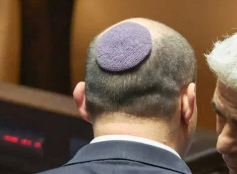 בנט