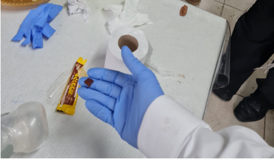 בית שמש: תינוק שנחנק מגוף זר ניצל בזכות טפיחות גורדון