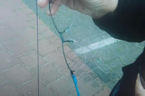 המשקפיים המרוסקות של המותקף