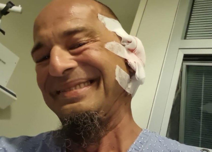 אוזן של מפגין נקרעה: מח"ש תבדוק את התנהלות השוטרים