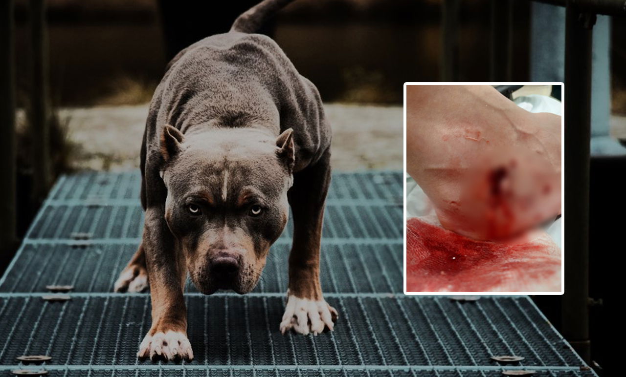 רגלה הפצועה של הנערה וכלב פיטבול