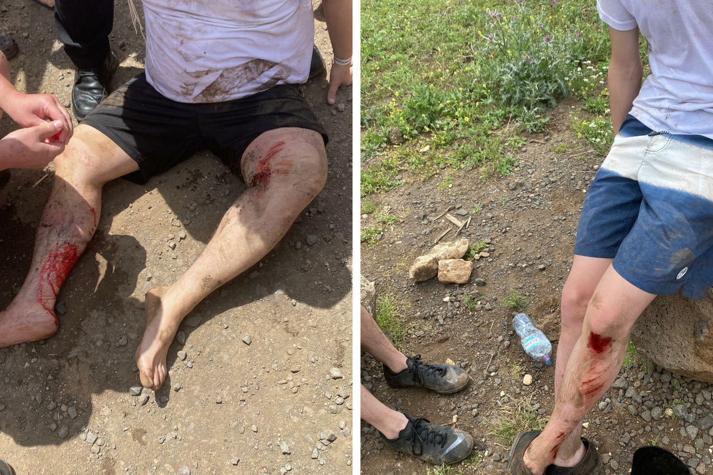 הפצועים מהדריסה