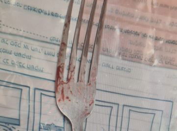 גבר בן 57 ממרכז הארץ, התווכח עם אחיו ונעץ מזלג בפניו | הוגש כתב אישום