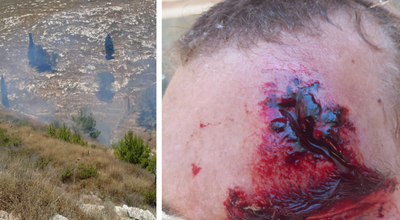 היהודי שנפצע לצד השריפה