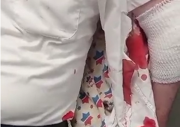 ניצול הפיגוע בבני ברק משחזר: "צעקתי 'דקרו אותי'" | צפו