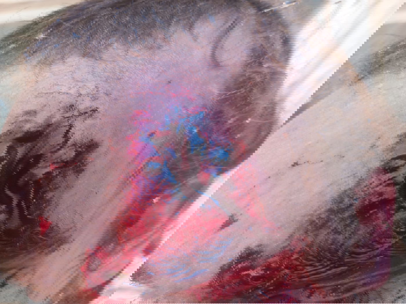 מחבלים הציתו שריפה ליד ההתנחלות חומש; ישראלי נפצע