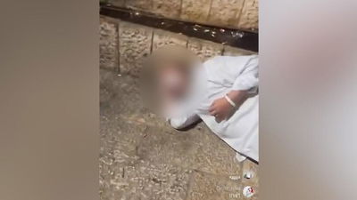 הוארך מעצר הערבים שהתעללו בנער החרדי בבית החולים