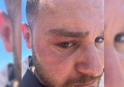 אגרוף לפנים: צלם עיתונות תקף שוטר בהפגנה ונעצר לחקירה