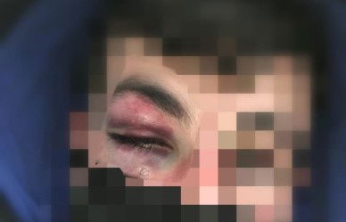 תלמיד הישיבה שהותקף