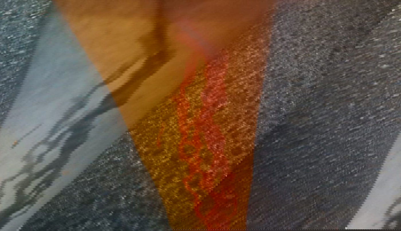 רגלו של השוטר שנפצע