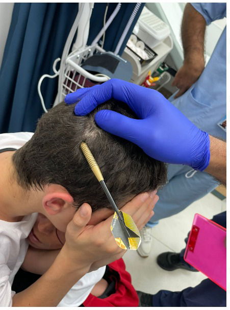 החץ בראשו של הנער