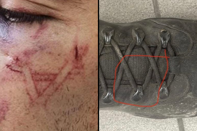 ההאשמה וההפרכה: הסימון בפניו של החשוד והצורה בנעל השוטר