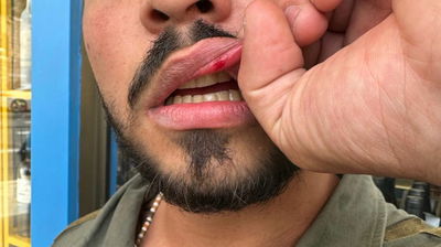 מפגיני שמאל טענו שישראל מבצעת 'רצח עם' ותקפו שוטרים