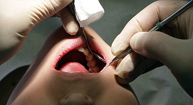 אילוסטרציה,