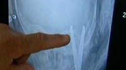 המספריים בצילום הרנגטן