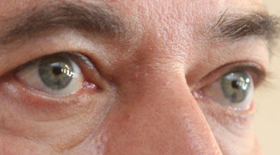 העין יכול הלהיות רעה. מאוד. צילום פלאש 90