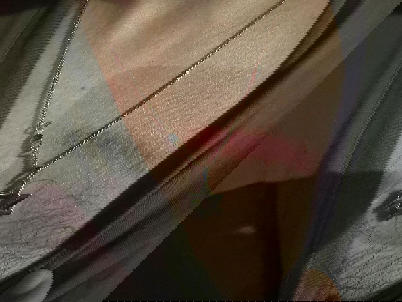 חבלה על חזהו של שוטר בעקבות תקיפה של מפר סדר אלים