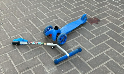 מצבו אנוש: רכב פגע קשות בפעוט שנסע על קורקינט בחנייה