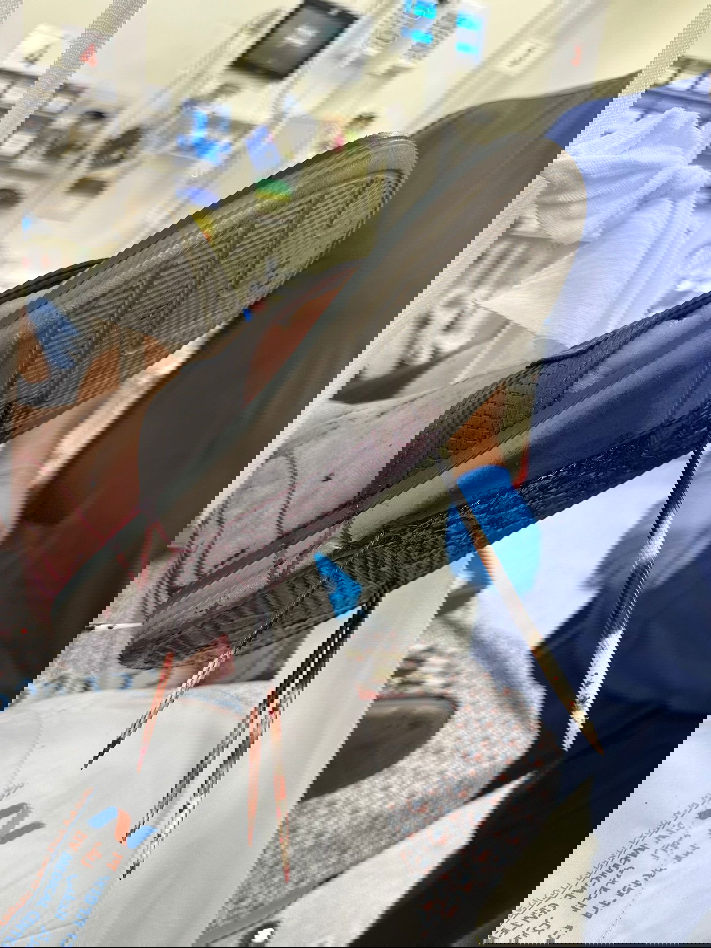 חצי הדורבן בגופו של האזרח