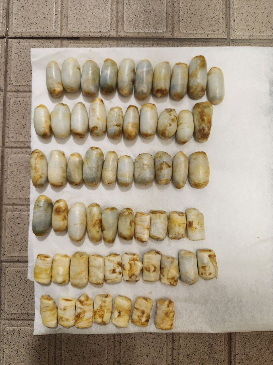 הזרגים שהתגלו בגופו של העציר