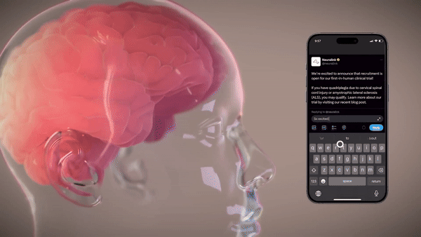 לתקשר עם מחשב - במחשבה בלבד: קנדה מצטרפת למאסק