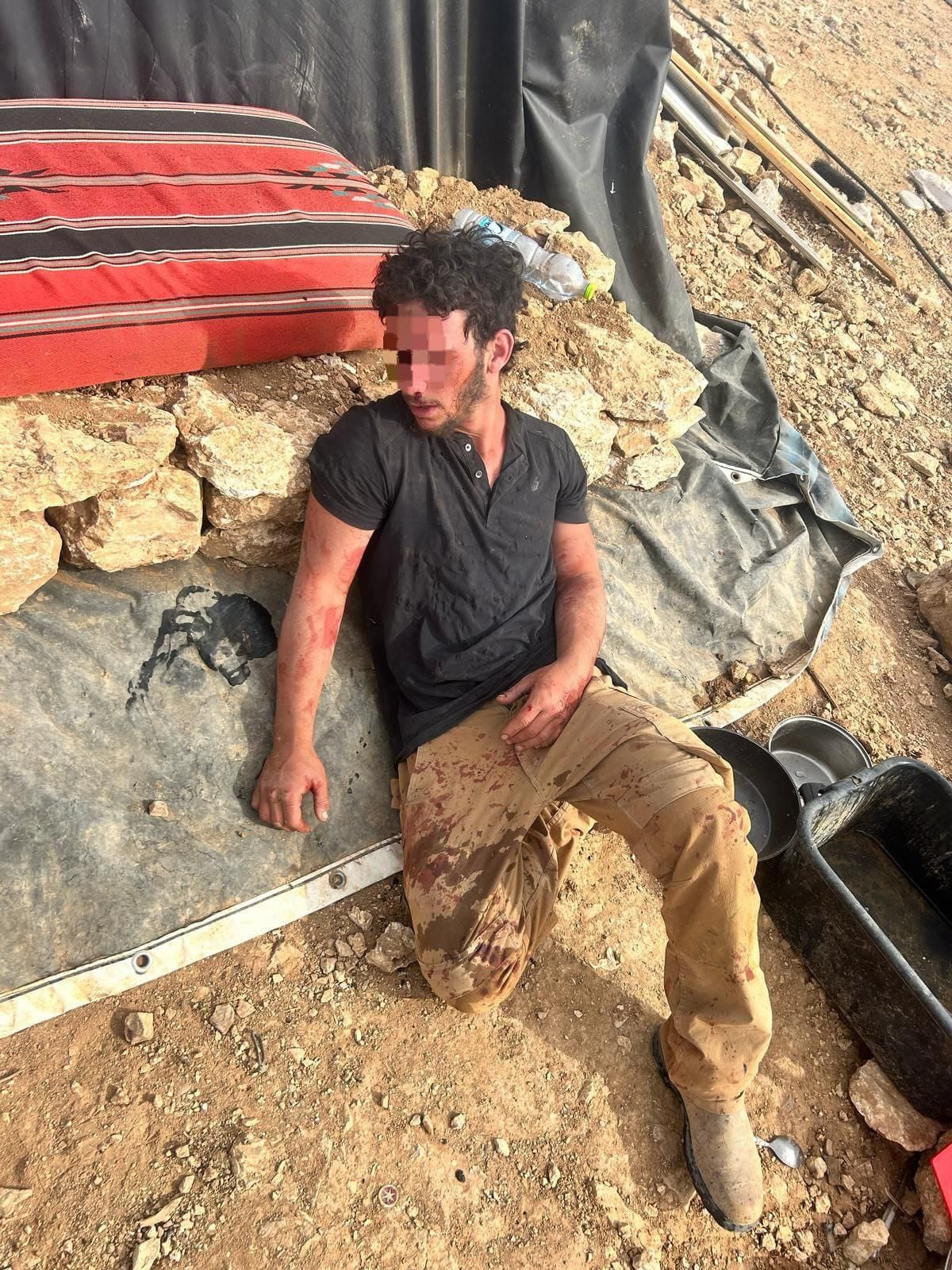 רועה צאן שהותקף