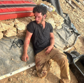 רועה צאן הותקף